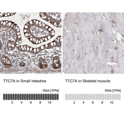 TTC7A Antibody, Novus Biologicals:Antibodies:Primary Antibodies